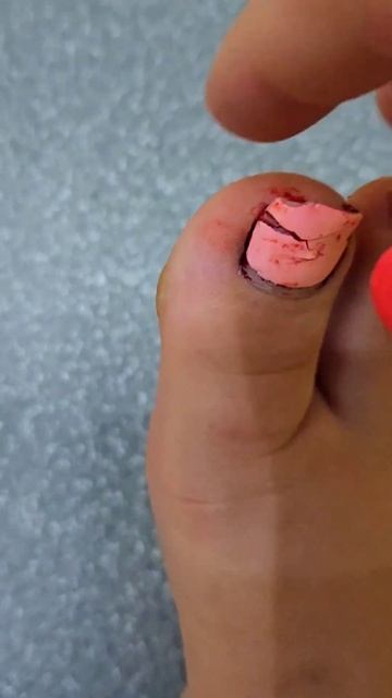 ТРАВМА НА ДЕТСКОЙ ПЛОЩАДКЕ смотреть онлайн