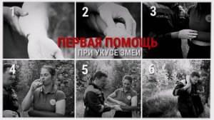 Первая помощь при укусе змеи