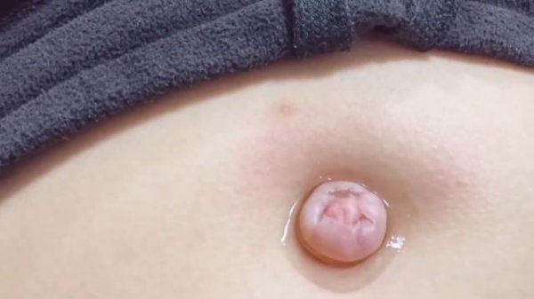 Ice in Navel. Girls navel torture. Лёд в пупке у девушки. [Navel pulse]