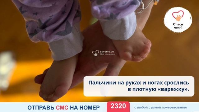 Спасите Аишу! Время уходит. Боль нарастает. Время операции выходит. смотреть онлайн