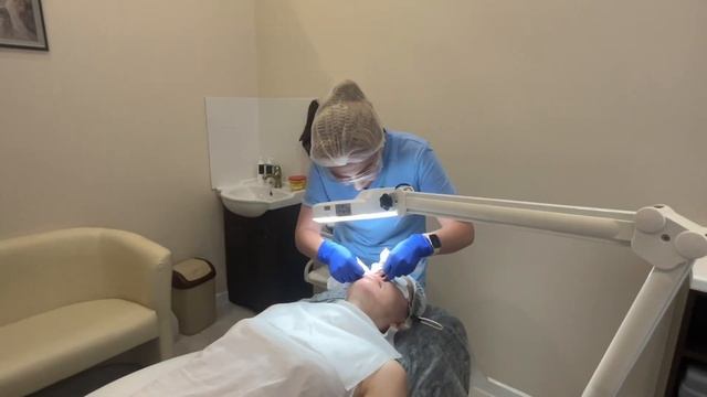 Чистка лица