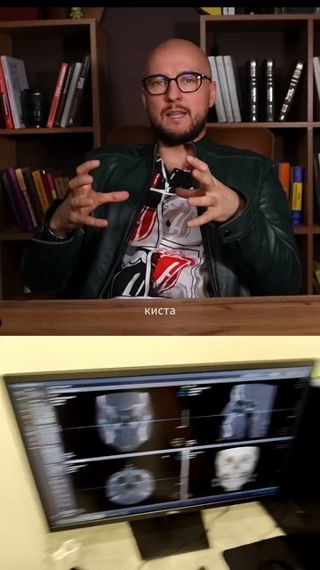 Зуб не болит — значит здоров? Стоматолог рассказывает смотреть онлайн