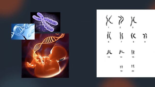 Трансплантация почки