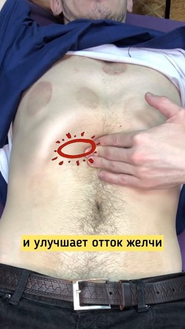 Массаж живота. Начало! Точка от всех болезней! #висцера смотреть онлайн