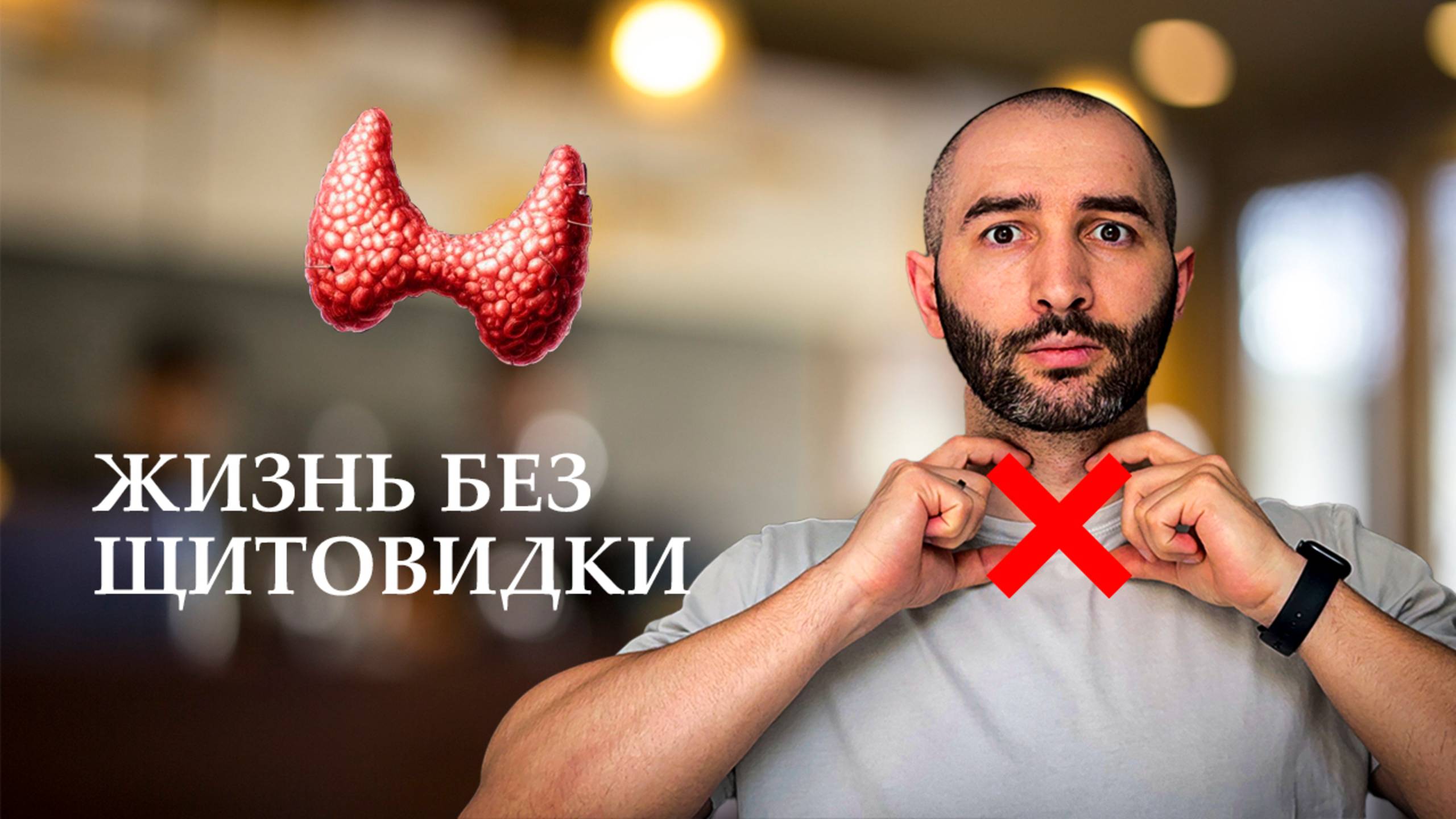 УДАЛИЛИ щитовидную железу: что дальше? Жизнь ПОСЛЕ УДАЛЕНИЯ щитовидки, рак и гормоны