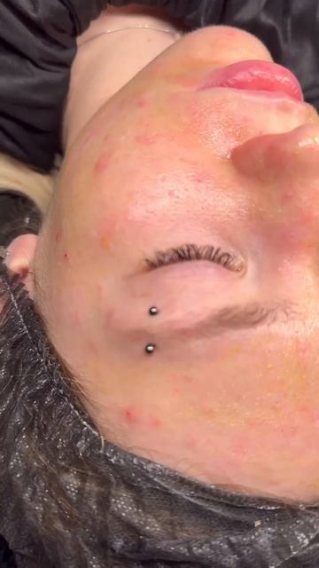 Чистка лица может быть очень даже приятной процедурой смотреть онлайн