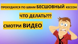 ОБЗОР и сравнение пластикового кессона ТИТАН и бесшовного кессона [купить кессон для скважины]