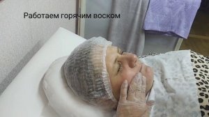 Депиляция усиков и подбородка воском