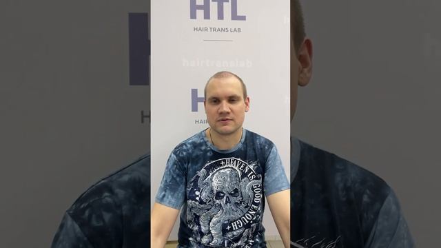 Пересадка волос в HairTransLab #пересадкаволос#hair#world#2024#рек? смотреть онлайн