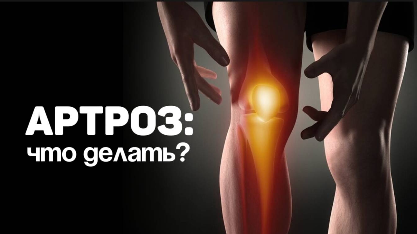 АРТРОЗ: ЧТО ДЕЛАТЬ? Семейный доктор Алена Братишко смотреть онлайн