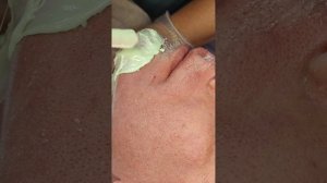 Депиляция мужской бороды!