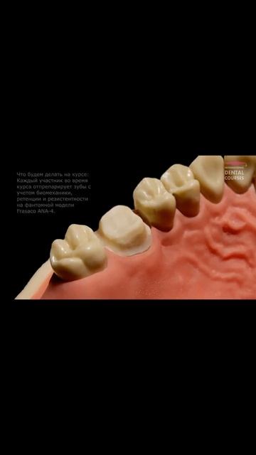 Курс по препарированию зубов под коронки - Евгений Рыб