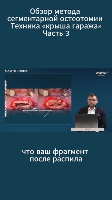Лекция: "Обзор метода сегментарной остеотомии. Техник? смотреть онлайн