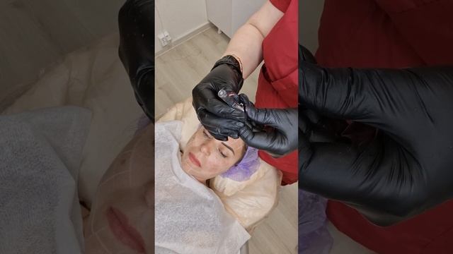 Мезоботокс-Без инъекций Hualuron pen