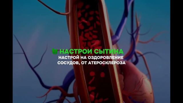 НАСТРОЙ НА ОЗДОРОВЛЕНИЕ СОСУДОВ, ОТ АТЕРОСКЛЕРОЗА