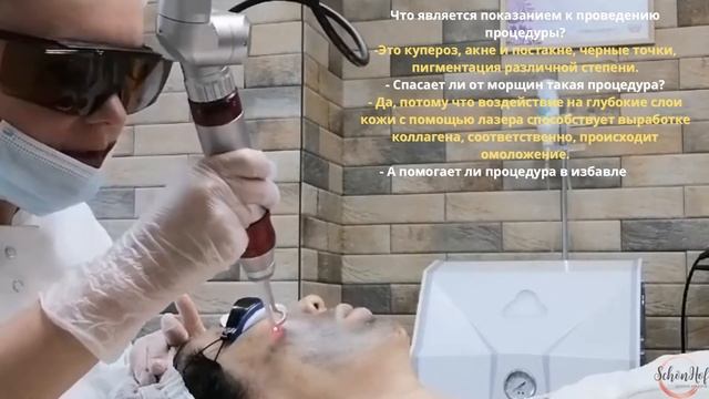 КАРБОНОВЫЙ ПИЛИНГ ДВОРИК КРАСОТЫ