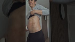 День 3й вакуумный массажер тестирую🍊убираю апельсин?