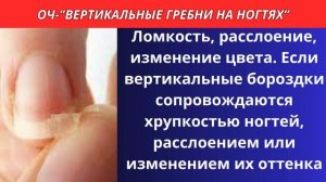 О чем говорят вертикальные бороздки на ногтях? Важные