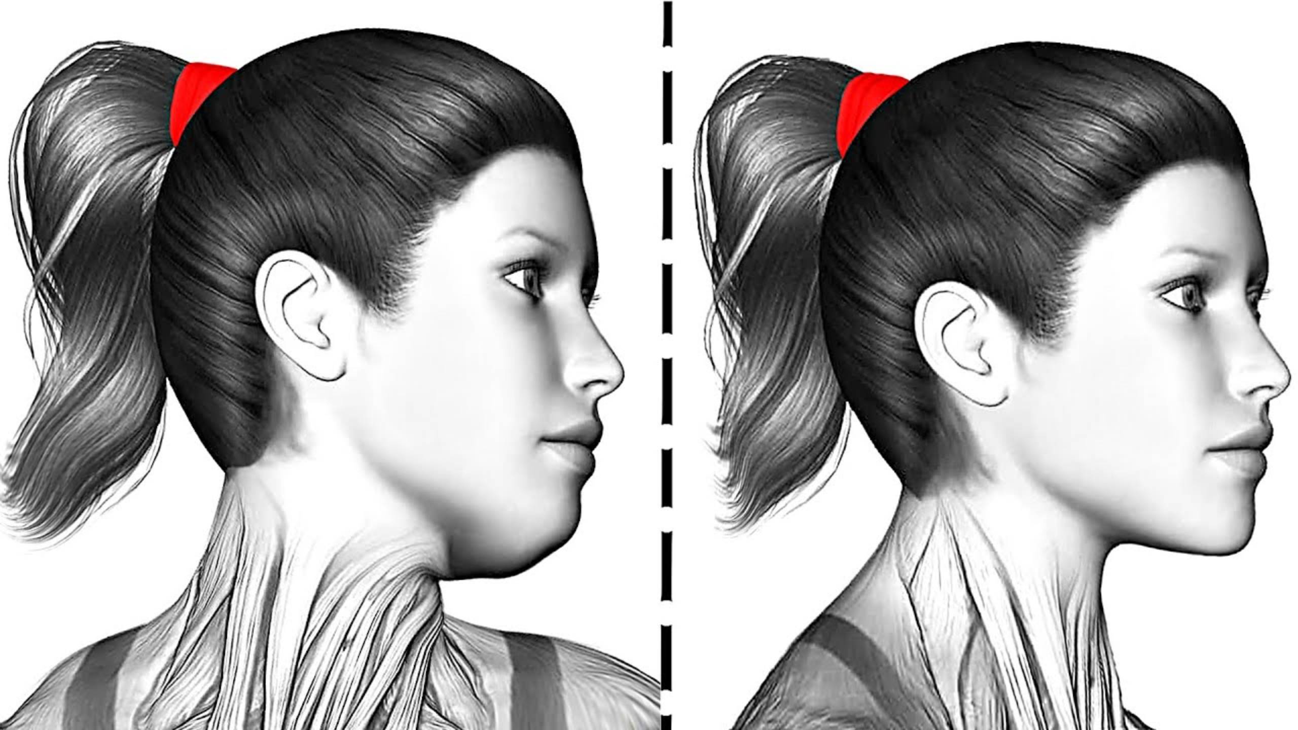 Избавьтесь от Двойного Подбородка смотреть онлайн