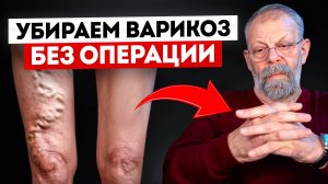 ❗️Памятка: как не пропустить тромб!