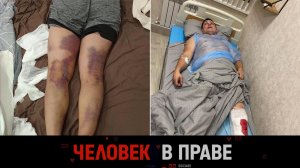 «Человек в праве» с Андреем Куницыным. Выпуск от 8 июня 2025 года