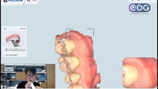 Техніка інтраорального сканування Helios 500 смотреть онлайн