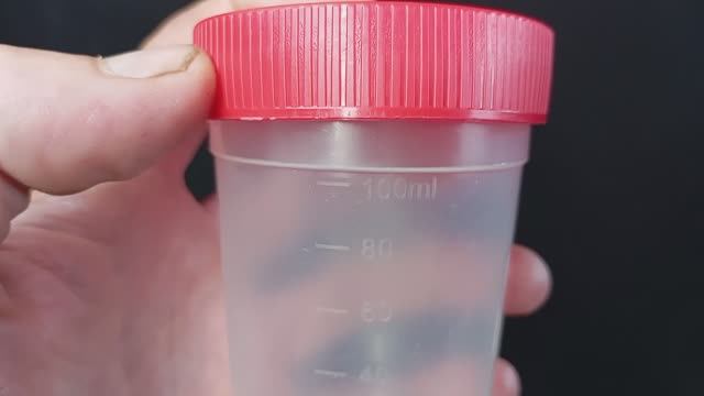 Баночка, ëмкость для анализов мочи смотреть онлайн