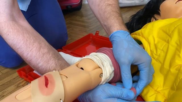 Наложение артериального жгута