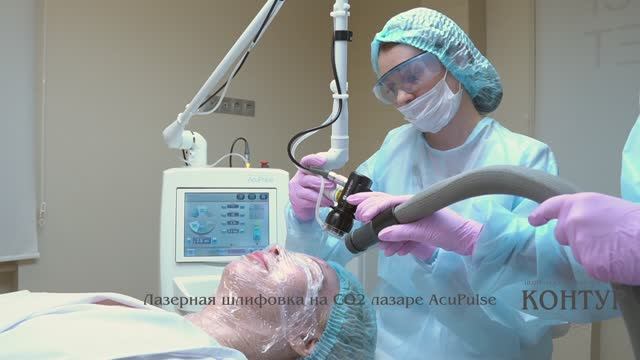 Лазерная шлифовка AcuPulse смотреть онлайн