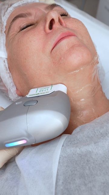 Продолжаем тему SMAS-лифтинга смотреть онлайн