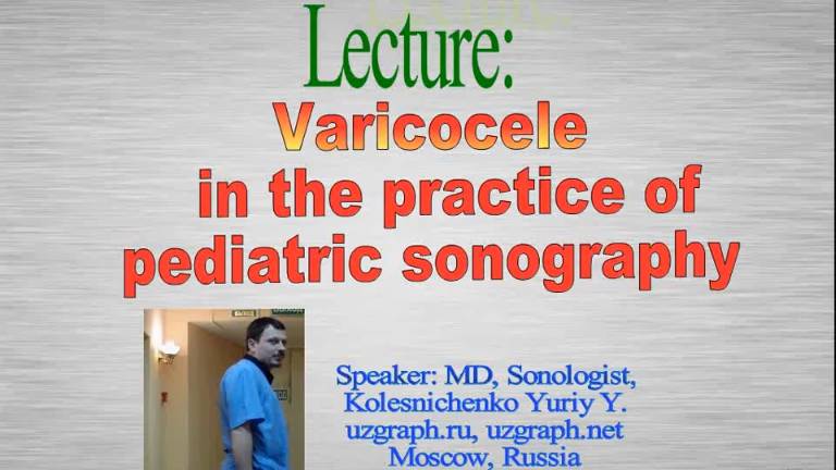 Varicocele in a child sonography смотреть онлайн