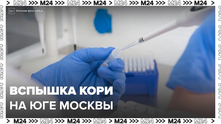 Вспышка кори выявлена в нескольких домах на юге Москвы - Москва 24