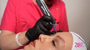 Удаление перманентного макияжа Щелочным ремувером. У?