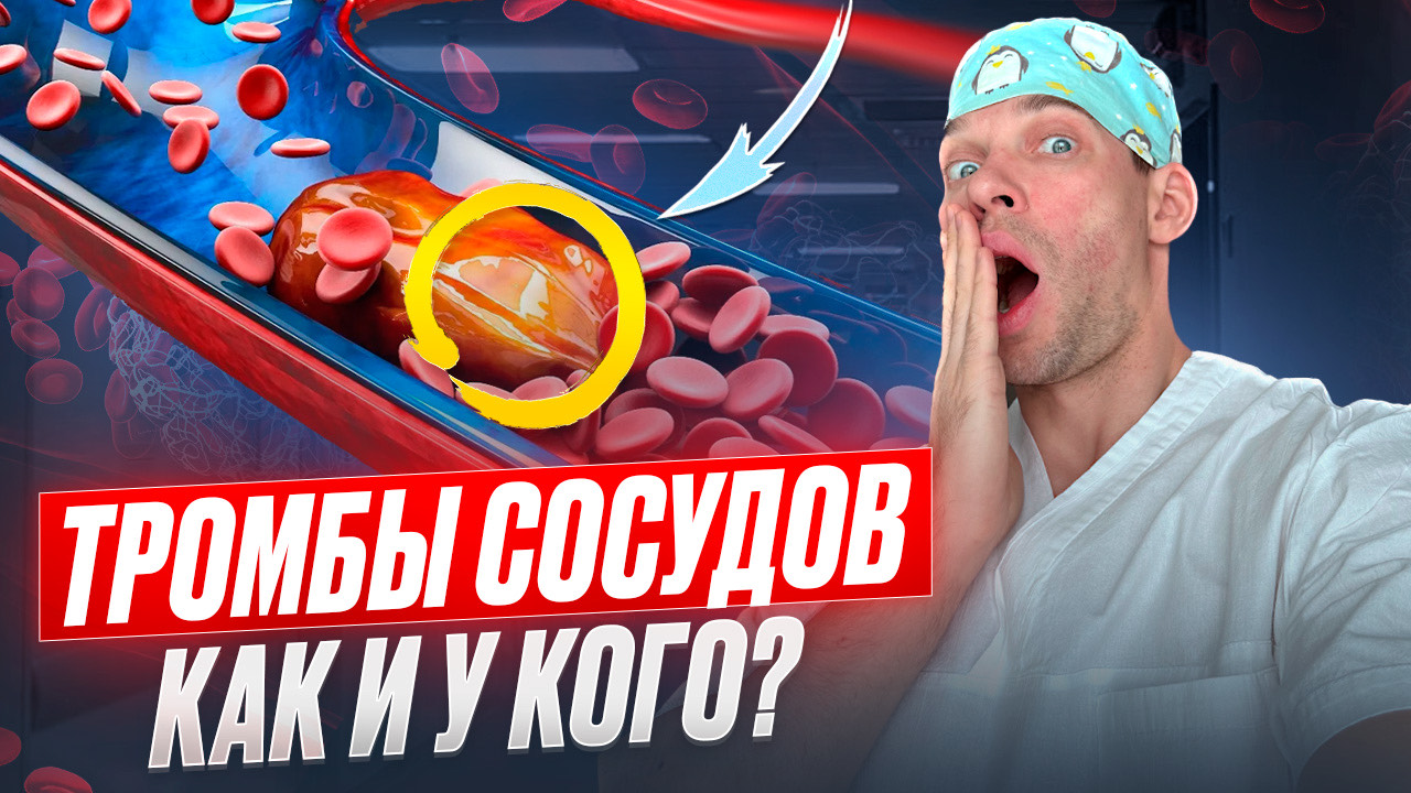 Тромбы сосудов. Симптомы и первая помощь. смотреть онлайн