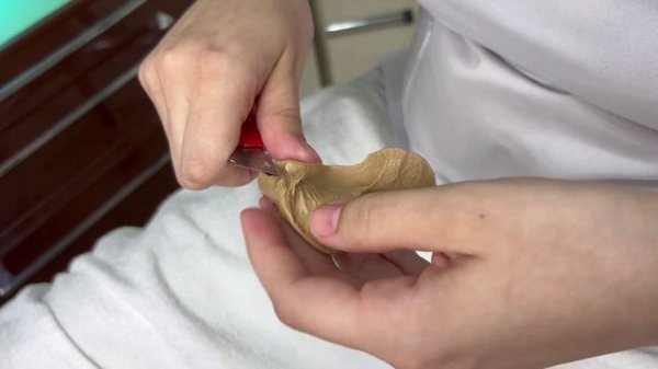 Изготовление индивидуального ортоза (ортеза) - процесс