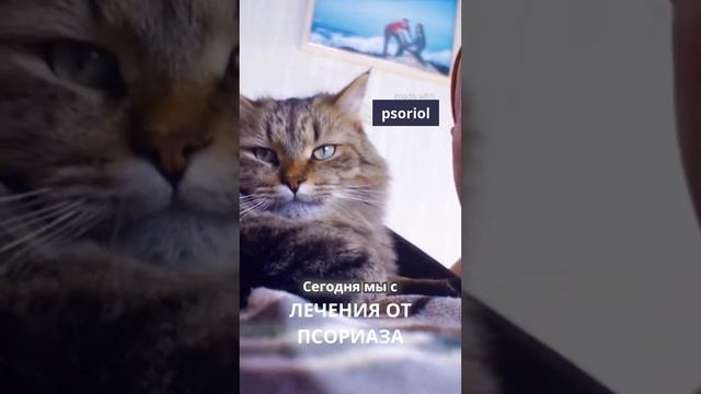 НА дому лечим псориаз