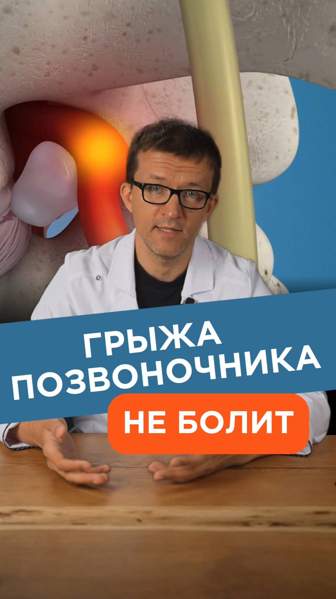 Может ли позвоночная грыжа не болеть?