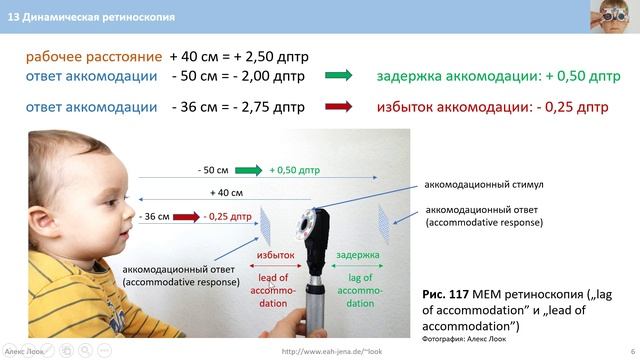 13 Динамическая ретиноскопия