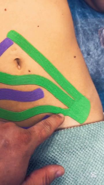 тейпирование при болезненных месячных #RTBalance #АВАР #месячные #боль #ВячеславРеут #СПб #тейп смотреть онлайн