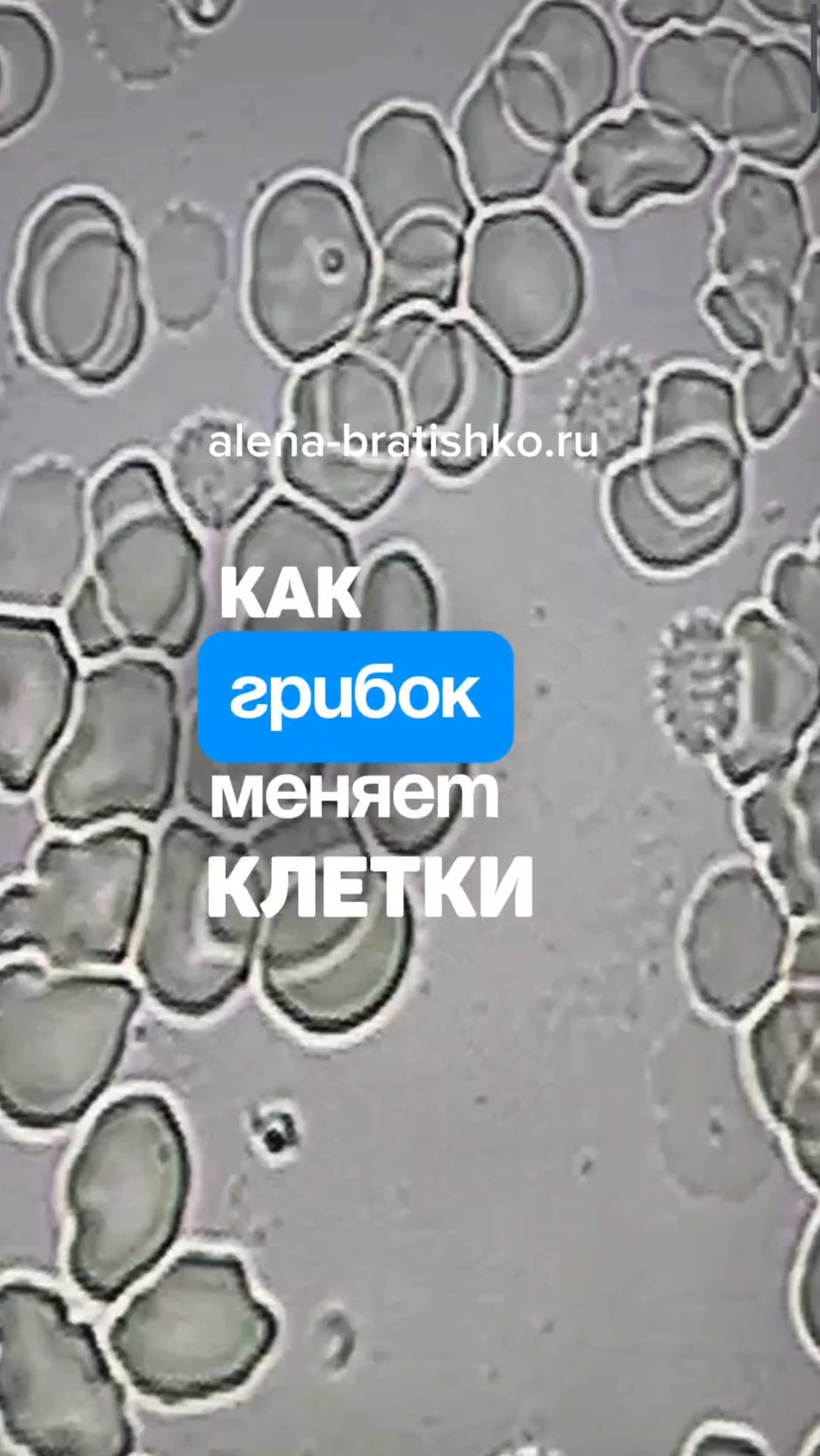 Как грибок (кандида) портит клетки. Семейный доктор Алена Братишко смотреть онлайн