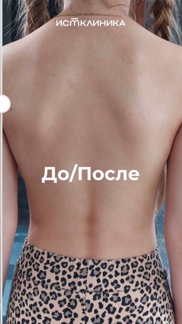 Нашей маленькой пациентке было больно просто вдохнуть. смотреть онлайн