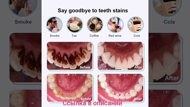 Электрический ультразвуковой скалер для зубов смотреть онлайн
