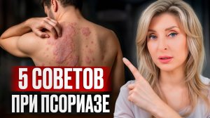 КАК ИЗБАВИТЬСЯ ОТ ПСОРИАЗА БЫСТРО И НАВСЕГДА? / Эффективные способы борьбы с кожными проблемами
