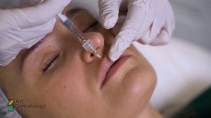 Контурная пластика губ с Belotero — ДО И ПОСЛЕ ✨