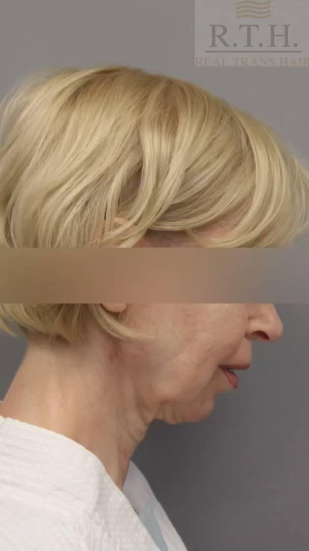 Устали видеть в зеркале не себя? Верните себе молодость, которую чувствуете внутри! смотреть онлайн