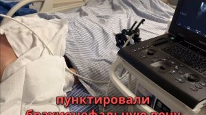 КАТЕТЕРИЗАЦИЯ ПОДКЛЮЧИЧНОЙ ВЕНЫ НАДКЛЮЧИЧНЫМ ДОСТУПОМ – КОНТРОЛЬ ПРОВОДНИКА