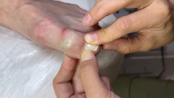 Установка Лайт Системы / Light System в педикюре. Сравнение ?