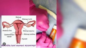 Вишневский мазьбен тампон жасау
