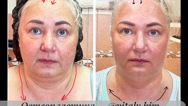 💥 ЛИШНИЙ ВЕС НЕ ПРИГОВОР ЛИЦУ И ШЕЕ!