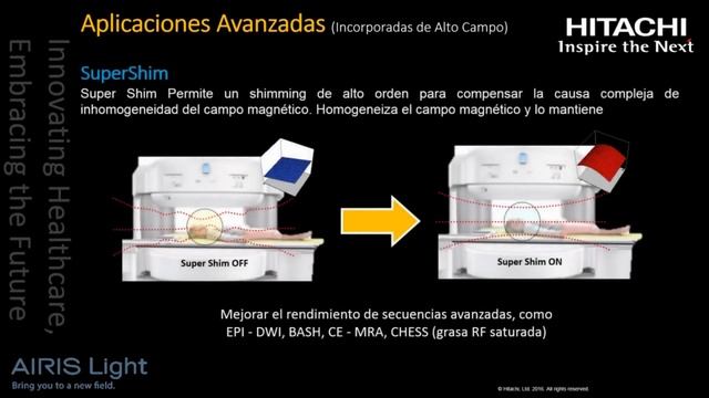 МРТ HITACHI AIRIS Light 0.25T